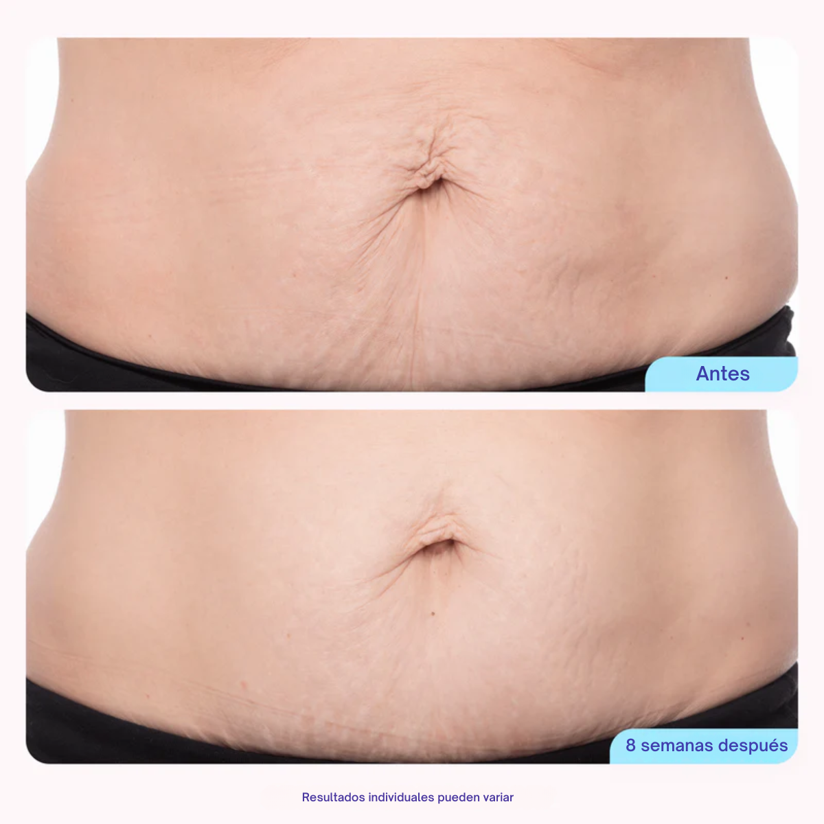 Crema reafirmante para el abdomen GoPure