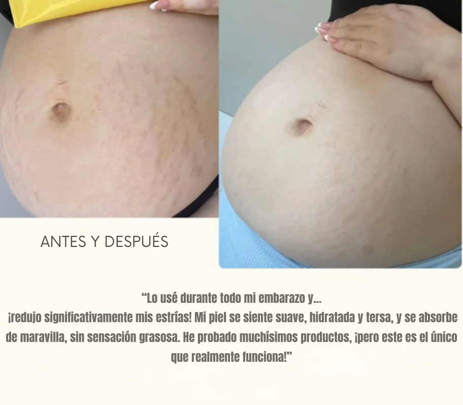 Dúo Reafirmante Corporal - Bang Body