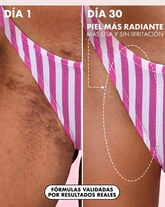 Goddess Glow™ - Aceite Regenerador Post-Depilación