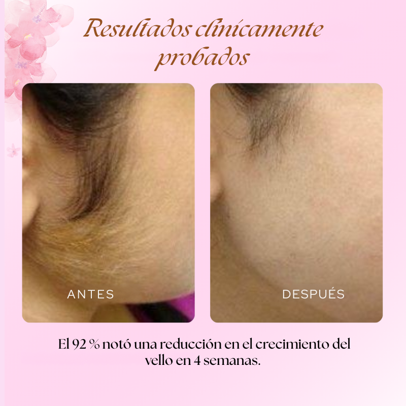 Cyperus Rotondus Oil - Aceite Reductor de Vello