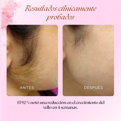 Cyperus Rotondus Oil - Aceite Reductor de Vello