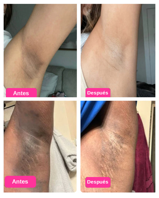 Peel Shot™ - Exfoliante Corporal Aclarante